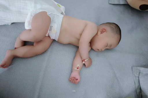 昌都宝宝脸上有白色斑块